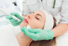 Aftercare Tips Following Professional Micro-Needling Services